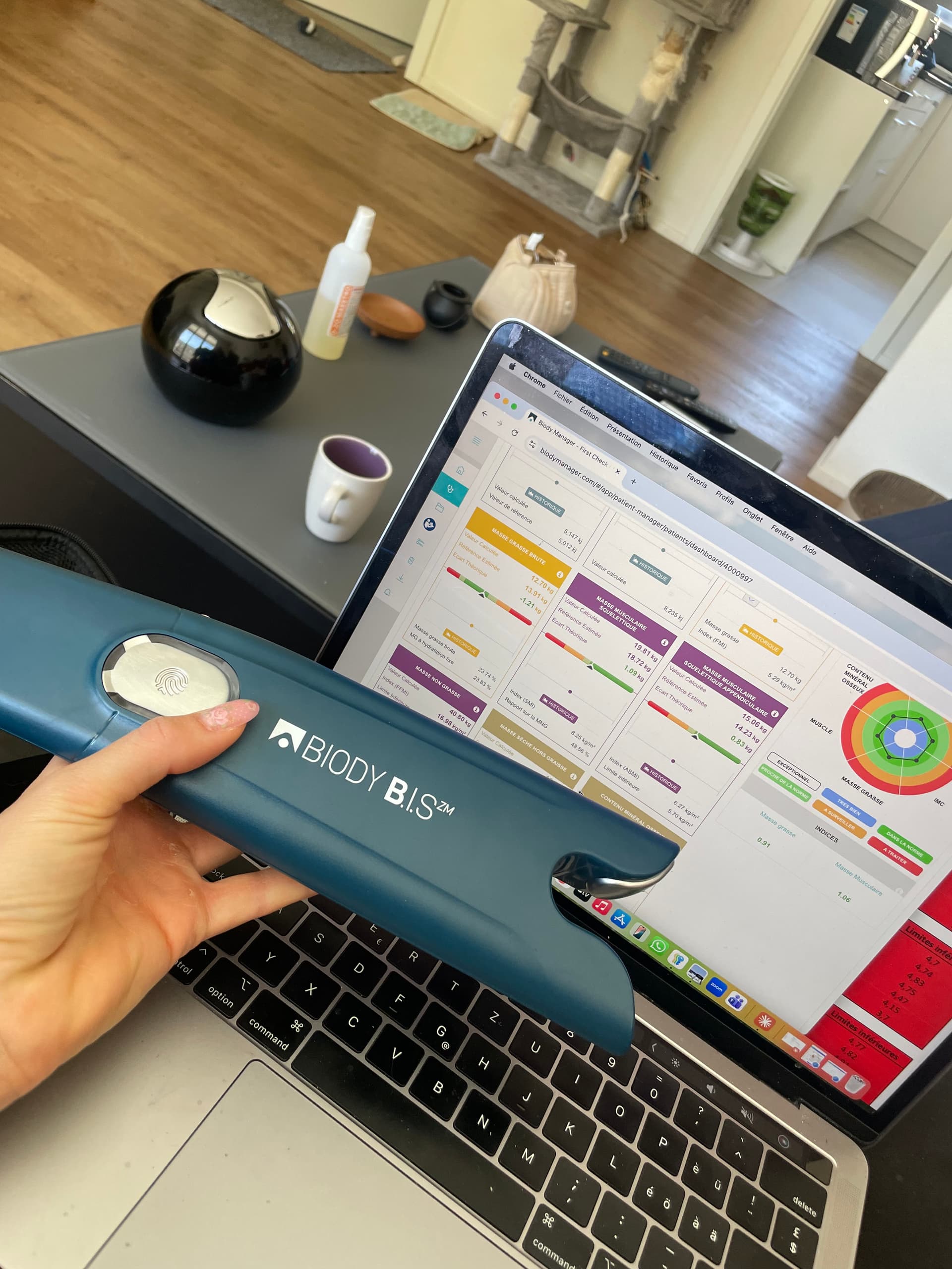 Appareil de mesure EBIODY devant l’écran des résultats